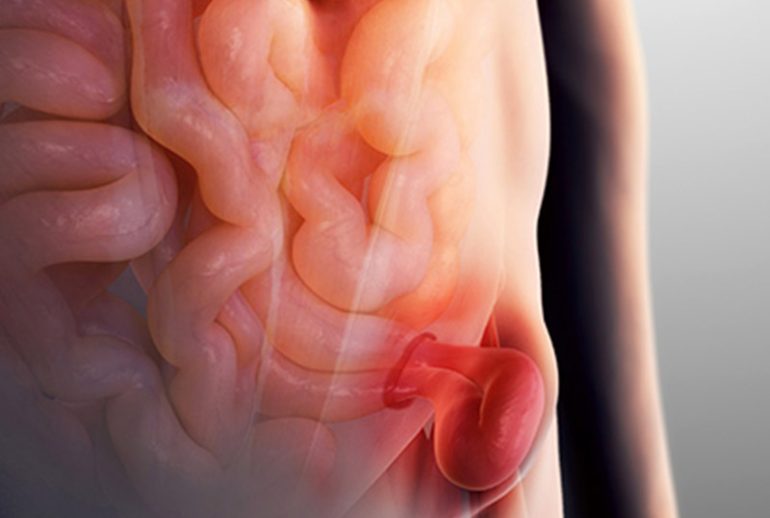 دکتر بیماری فتق - بندرعباس