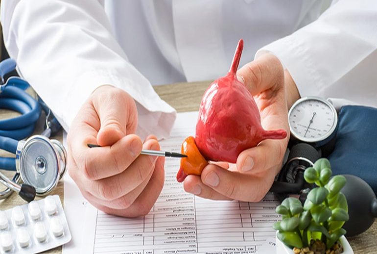 دکتر عفونت پروستات - مشهد